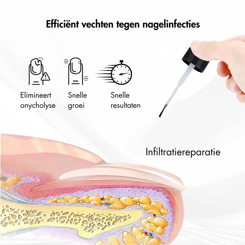 Nagelkracht™ | Nagelversterking en Herstelserum