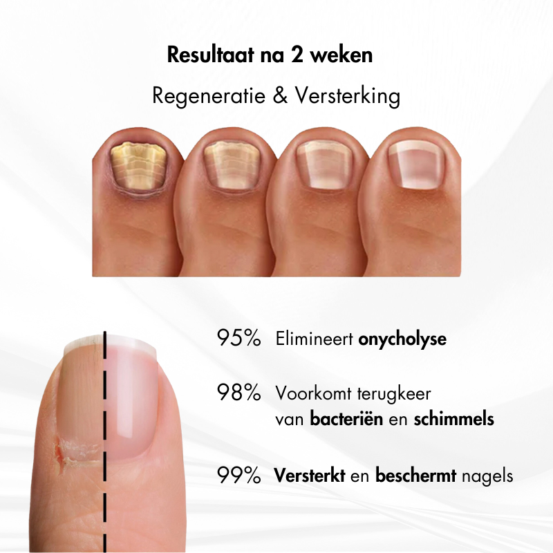 Nagelkracht™ | Nagelversterking en Herstelserum