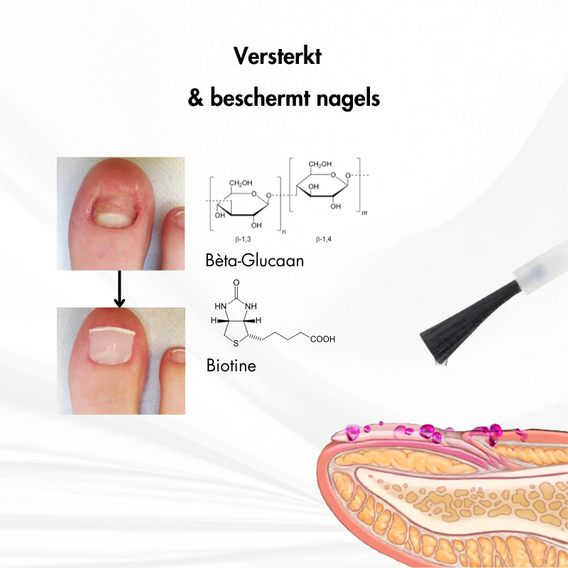 Nagelkracht™ | Nagelversterking en Herstelserum