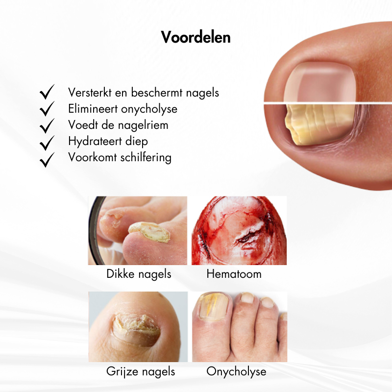 Nagelkracht™ | Nagelversterking en Herstelserum