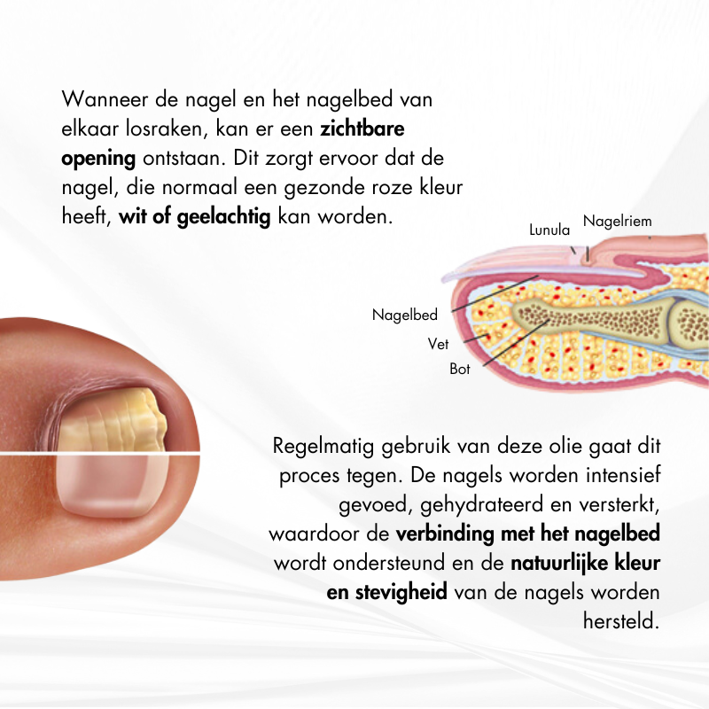 Nagelkracht™ | Nagelversterking en Herstelserum