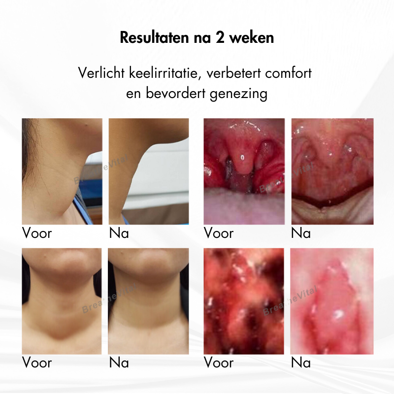 AdemVrij™ | Keel- en Hoestverzachtende Lymfespray